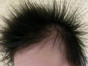 つむじ割れ 生えグセの切り方 なおかつ収まる切り方の考え方 くせ毛専門 くせ毛が好きになる美容室 ヘアカラー アレルギー でお困り方の美容室 徳島 阿南 ゆい