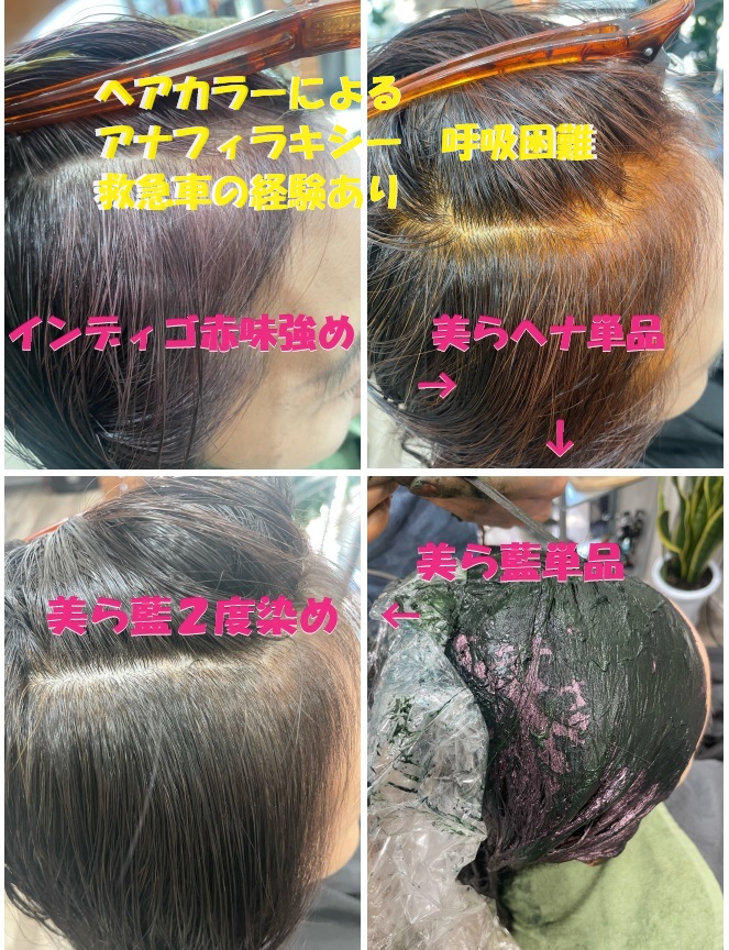 ＃呼吸困難　＃救急車　＃ヘアカラーアレルギー　＃美らヘナ　＃美ら藍　#2度染め　＃天然100%