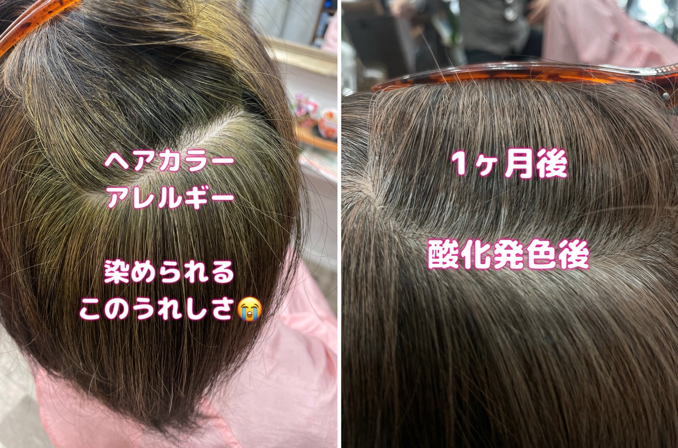 ＃ヘアカラーが痛くて　＃痒くて　＃染められるうれしさ　＃初めてのヘナ　＃頭皮が快適　