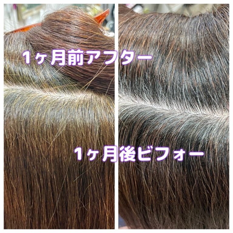 ＃白髪染めが痛いかゆい　＃アルカリ白髪染めからヘナに変えて　＃1ヶ月後の様子